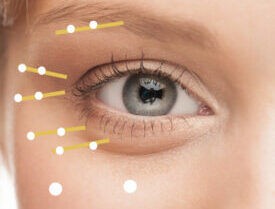 Skin Booster Sunekos Stoke on Trent